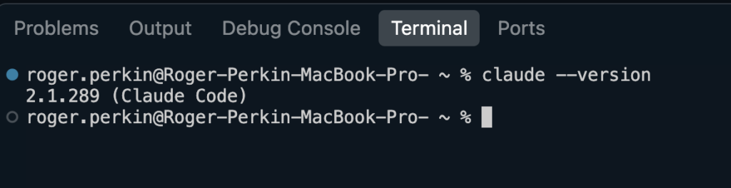 how to check Claude Code version